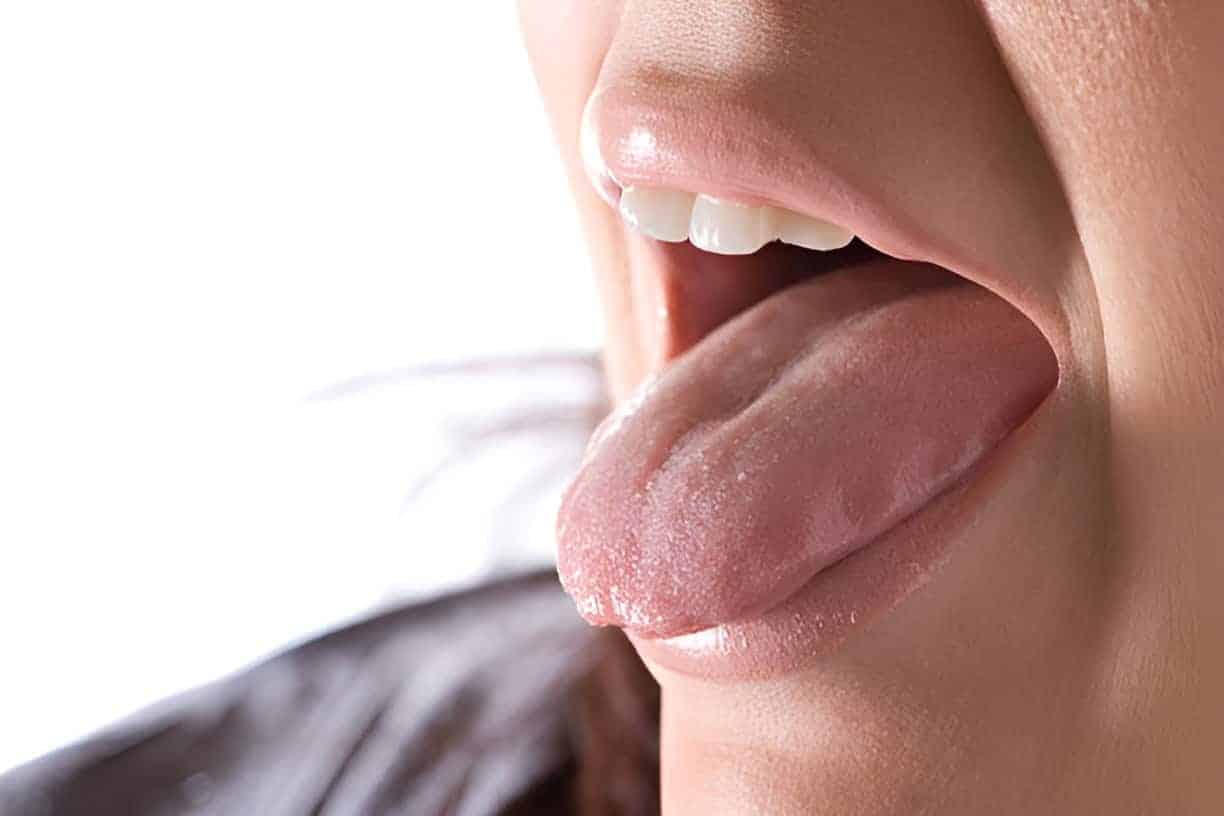 3. Excessive Salivation