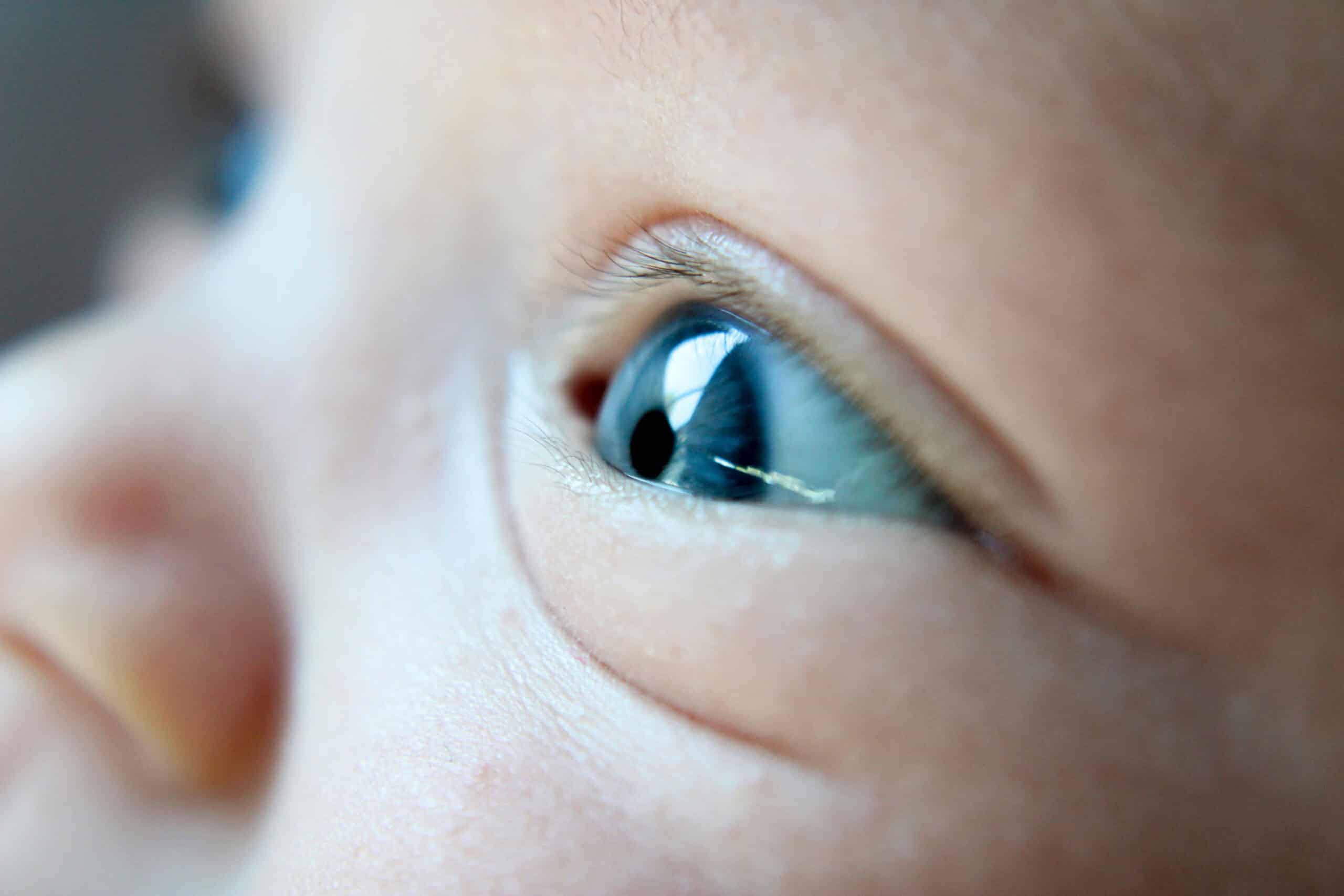 1. Bright, Responsive Eyes