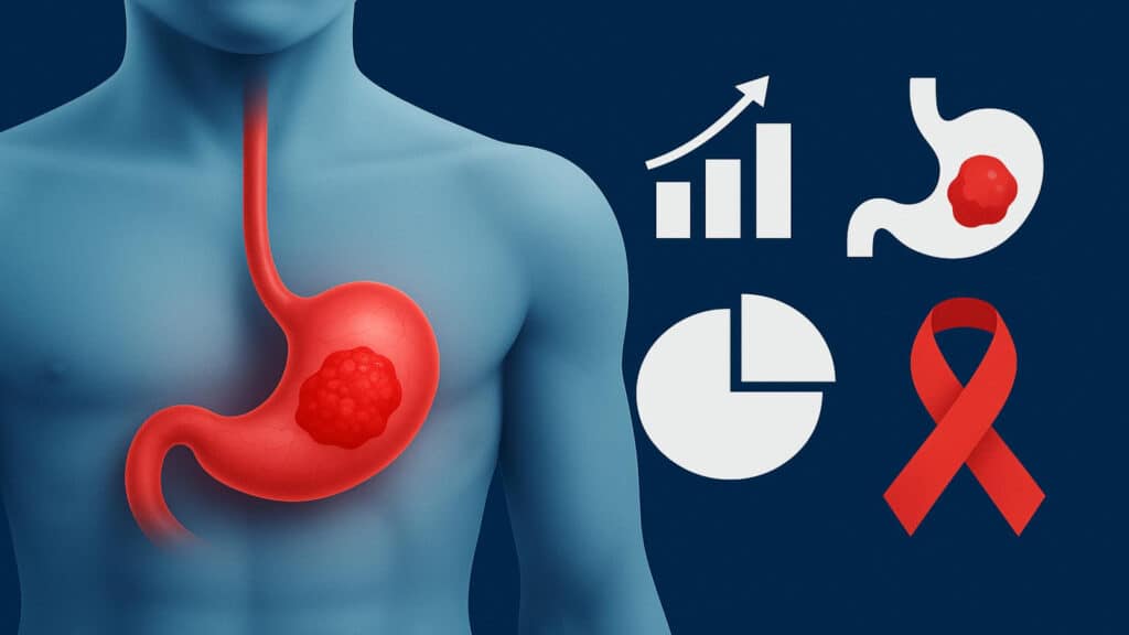 Potential Early Warning Signs of Stomach Cancer